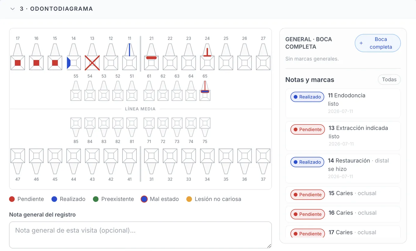 Odontodiagrama con dientes permanentes y temporales, leyenda de estados y notas fechadas por diente.